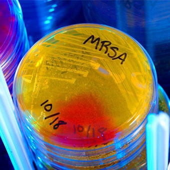 mrsa-s2-methicillin-resistant